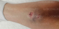 60-летнюю липчанку у церкви покусала чипированная собака - Gorod48.ru